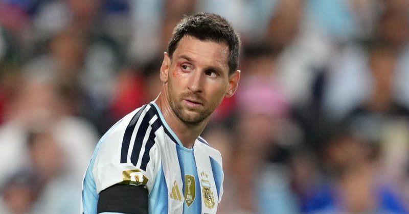 England gegen Argentinien: Hotels der Nationalteams abgeriegelt